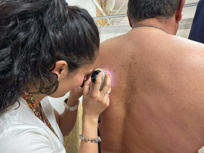 El servicio de Dermatología del Hospital Universitario Costa del Sol ha detectado en 2023 un total de 161 melanomas, en 153 pacientes, puesto que ocho de ellos presentaba más de un melanoma al mismo tiempo..El servicio de Dermatología y el Proyecto Soludable del Hospital Universitario Costa del Sol (HUCS) han celebrado este jueves una jornada de puertas abiertas para conmemorar el Día Mundial del Melanoma -que tiene lugar el 23 de mayo- en la que se ha dado a conocer que el año pasado se detectó en este centro un melanoma cada dos días.POLITICA JUNTA